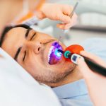 how long do dental fillings last